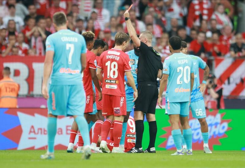 Удаление Дугласа Сантоса